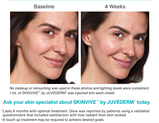 Skinvive Before & After - Wall, NJ - Mirelle Anti Aging