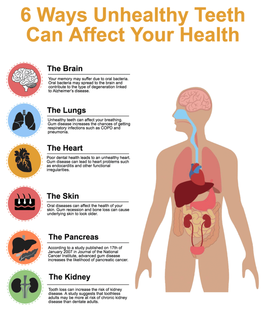 A poster showing six ways unhealthy teeth can affect your health - Wall, NJ - Mirelle Anti Aging