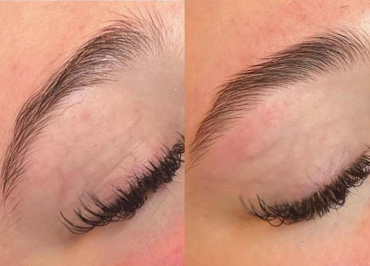 Keralase® Eyebrow Rejuvenation at Mirelle
