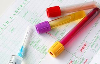 Drug Tests — Medical Specimens in Gary, Indiana