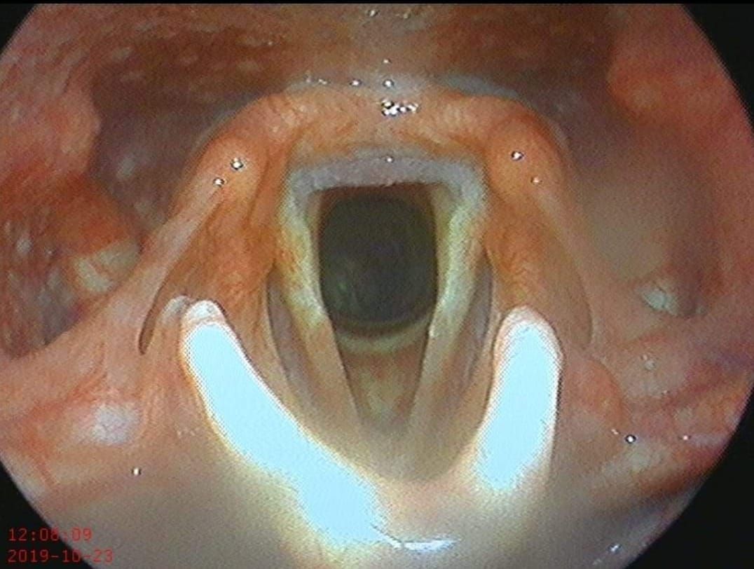 DR CESAR NIEBLA BELTRÁN - Microcirugía endonasal, de laringe y de oído