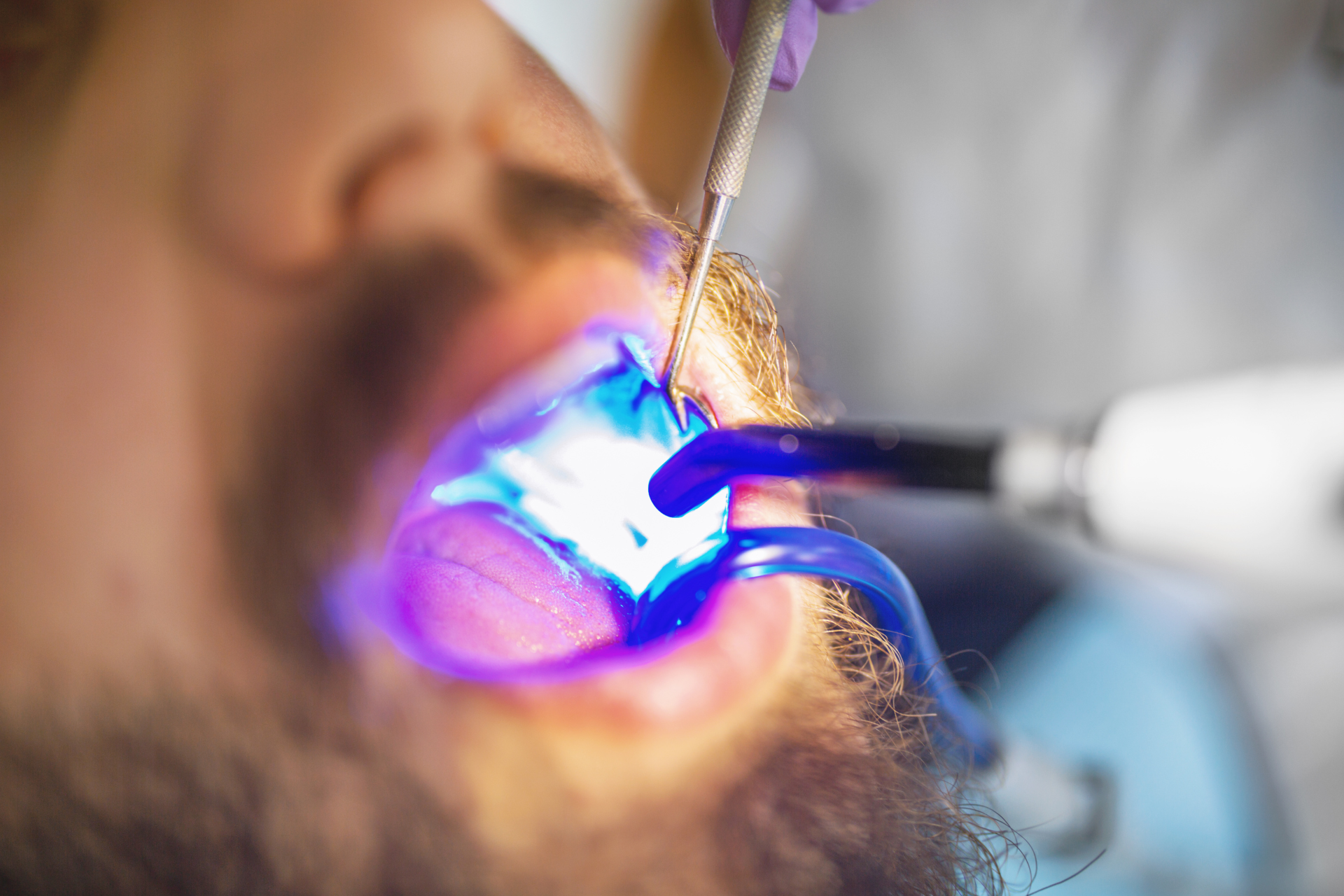 Laser Therapy in Palo Alto Dentistry