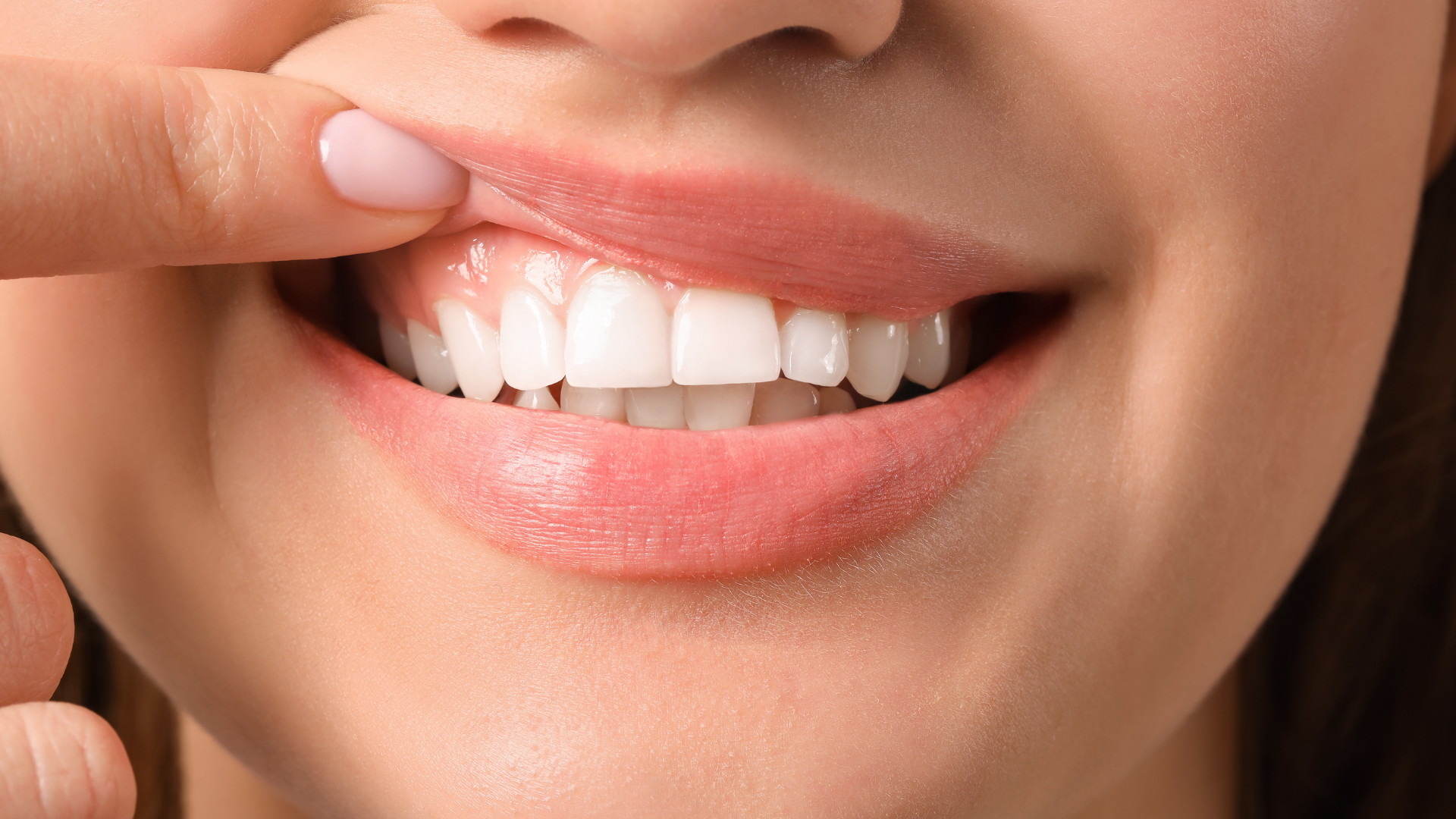 A person with their mouth open, an orthodontist holding a clear aligner. Blue gloves are visible.