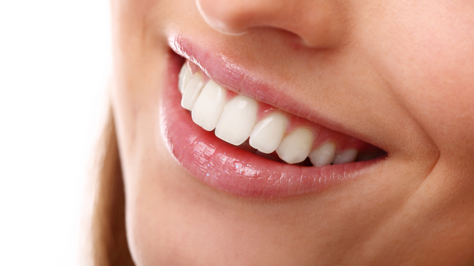 A close up of a woman 's smile with white teeth.