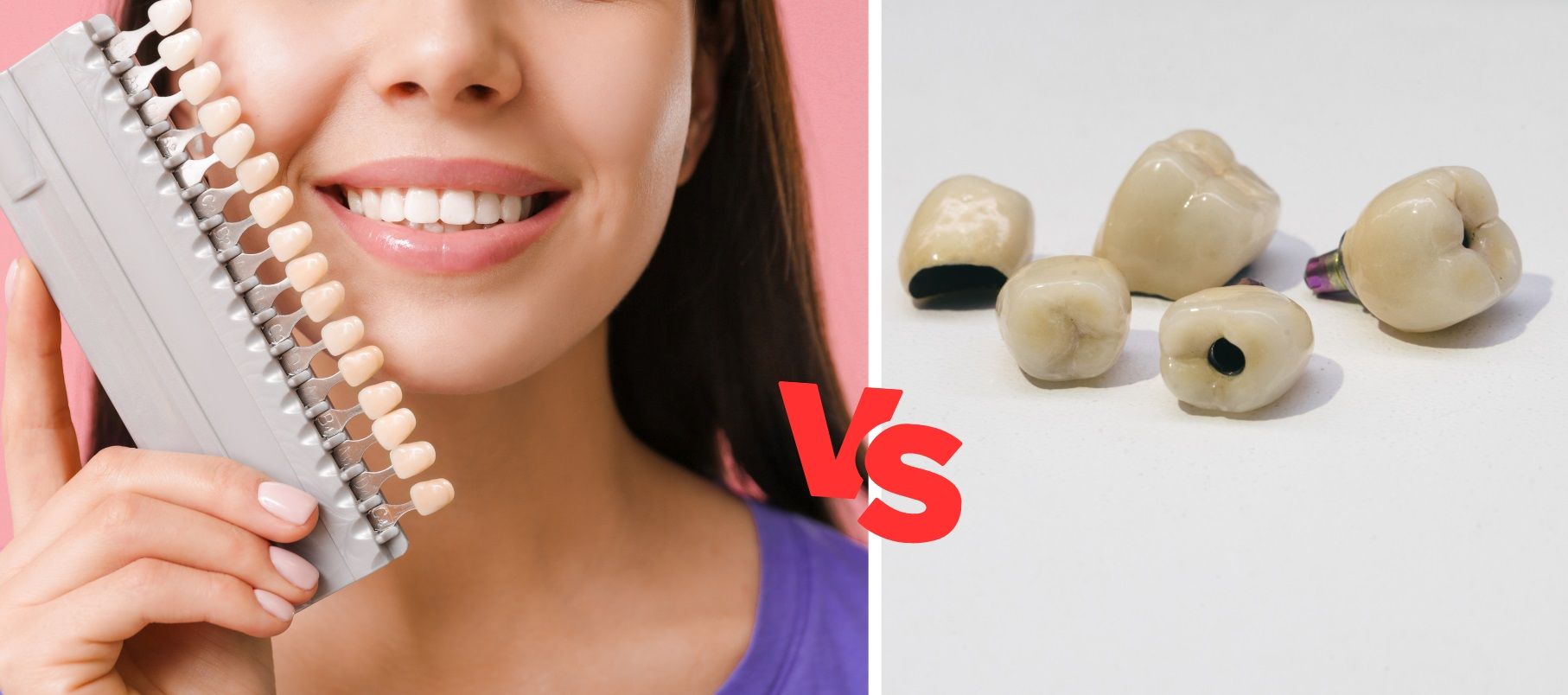 Dental Veneers vs. Dental Crowns