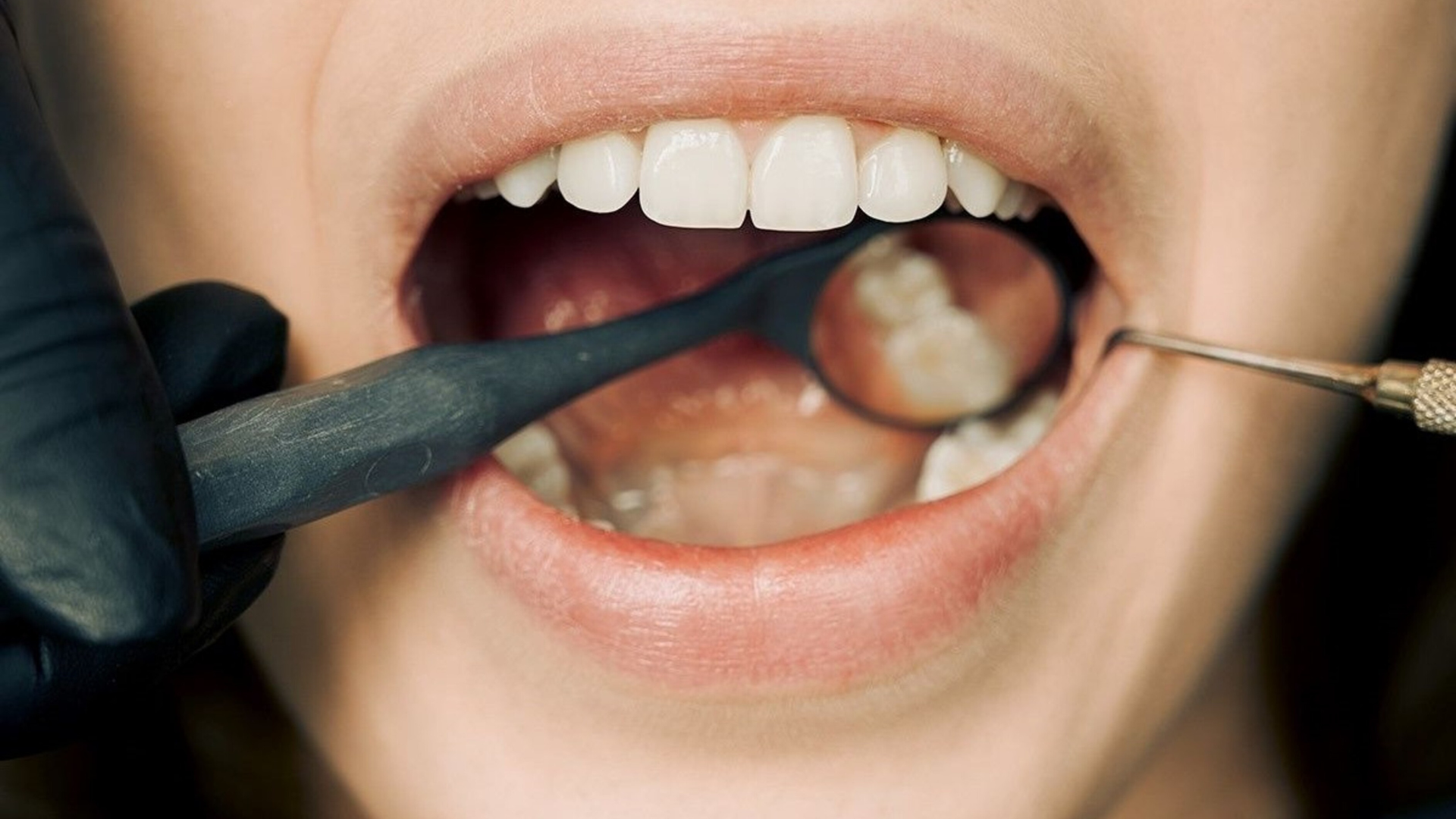 A woman is getting her teeth examined by a dentist.