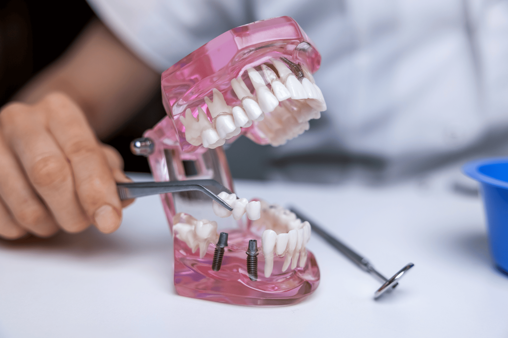 Image of sample for dental implants