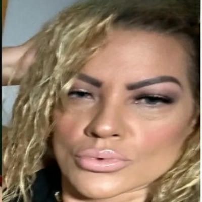 A close up of a woman 's face with full lips after lip filler treatment.