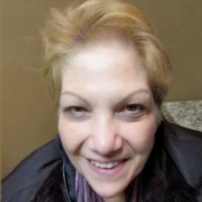 A close up of a woman 's face without wrinkles after botox treatment.