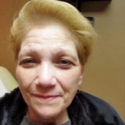 A close up of a woman 's face with wrinkles before botox treatment.