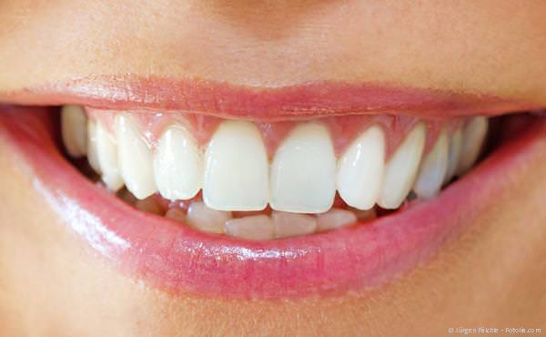 Weiße Zähne nach dem Bleaching
