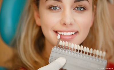 Kontrolle der Zahnaufhellung mit der Farbskala