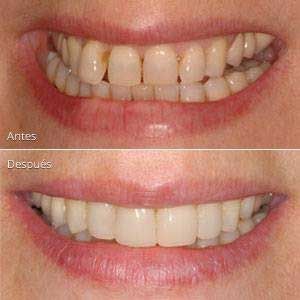 AB Dental - limpiezas dentales