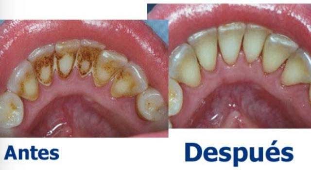 AB Dental - tratamientos dentales