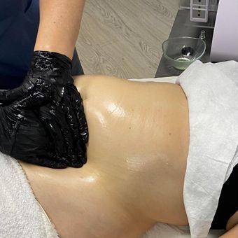Persona recibiendo un masaje abdominal con manos enguantadas. Piel brillante y aceitosa sobre una camilla de masaje.