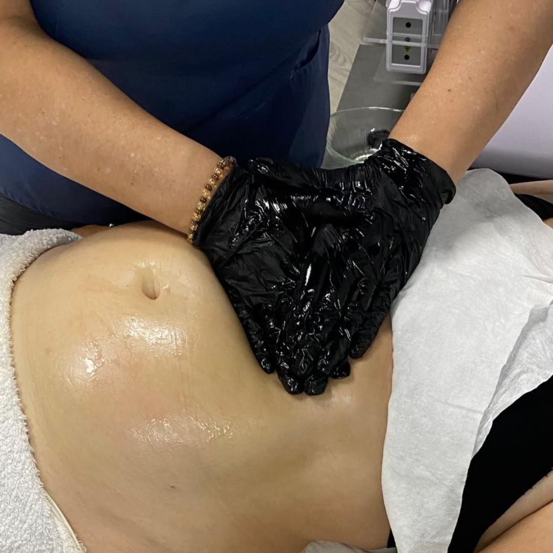 El abdomen de una persona está siendo masajeado con manos enguantadas, cubiertas de aceite, sobre una toalla blanca.