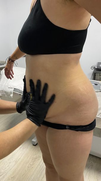 Se examina el torso de una persona; una mano enguantada palpa el costado. Viste ropa negra (parte superior e inferior) y se encuentra en el interior.