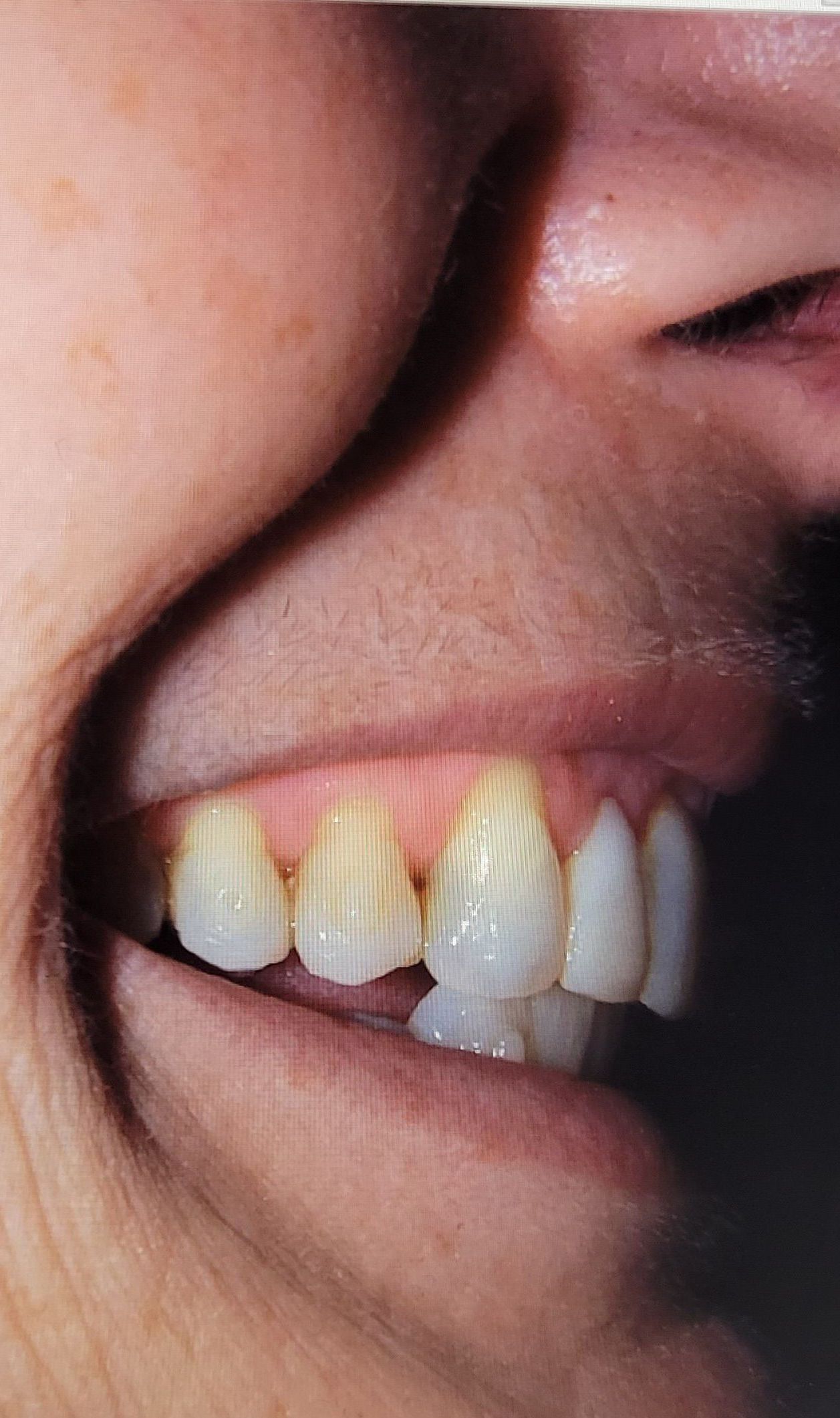 A close up of a person 's mouth with their teeth showing.