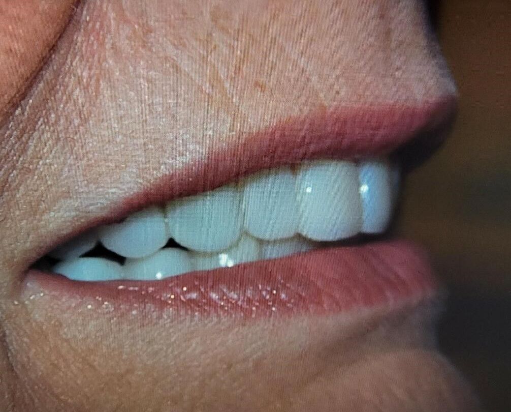 A close up of a woman 's mouth with white teeth.