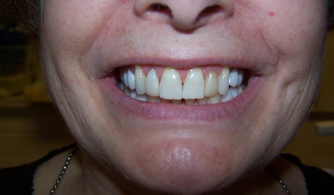 A close up of a woman 's mouth with her teeth showing.