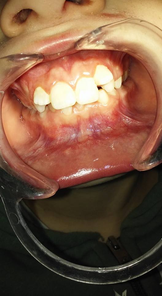 DRA BLANCA GODOY ODONTOLOGÍA INTEGRAL