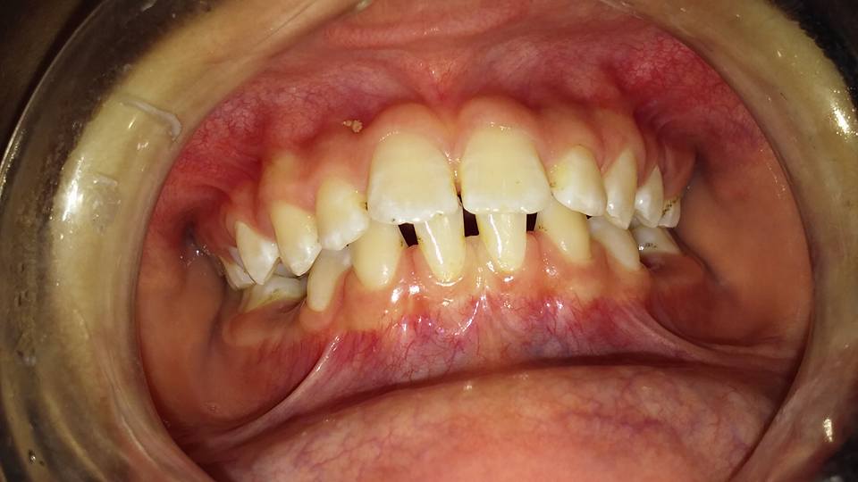 DRA BLANCA GODOY ODONTOLOGÍA INTEGRAL