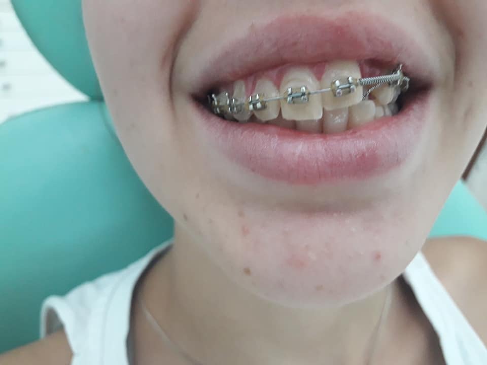 DRA BLANCA GODOY ODONTOLOGÍA INTEGRAL