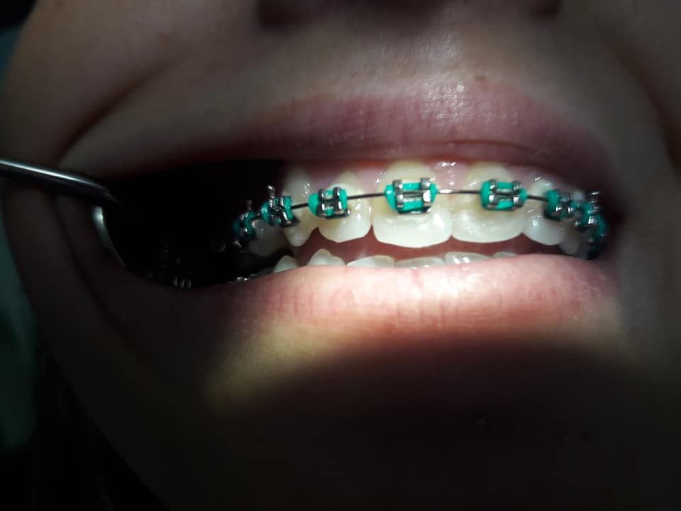 DRA BLANCA GODOY ODONTOLOGÍA INTEGRAL