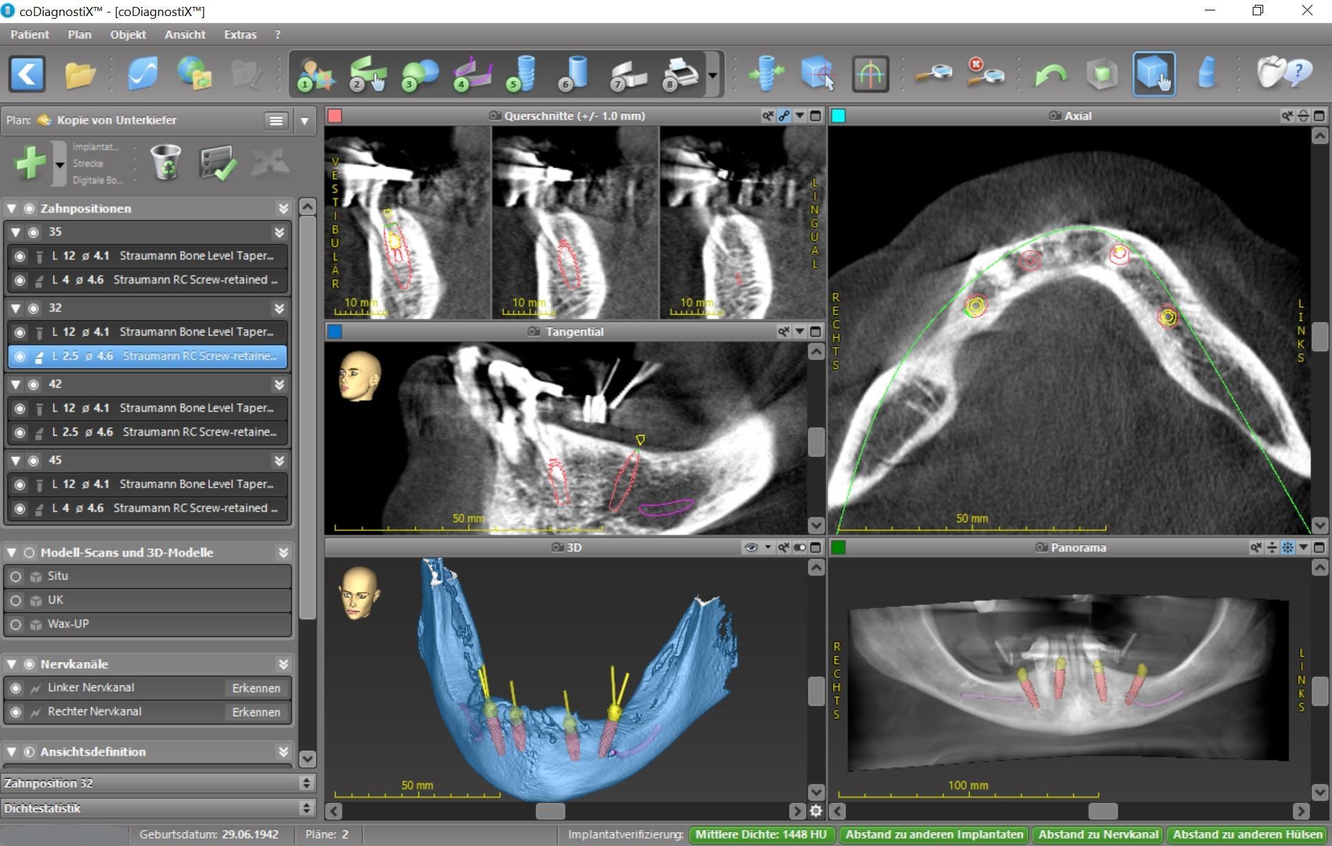 Implantatprothetik und 3D-Implantatplanung