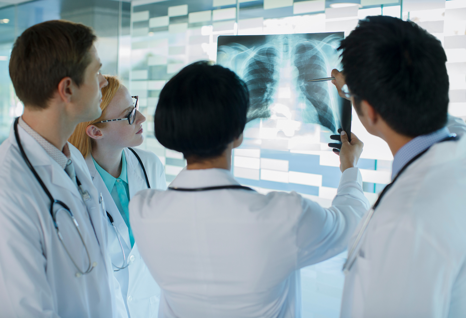 A group of doctors are looking at an x-ray of a patient 's lungs.