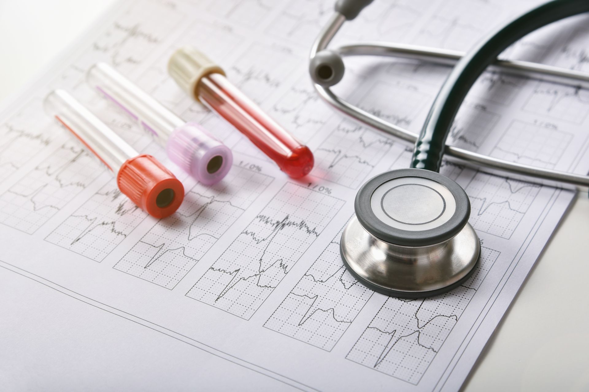 A stethoscope is sitting on top of a medical chart