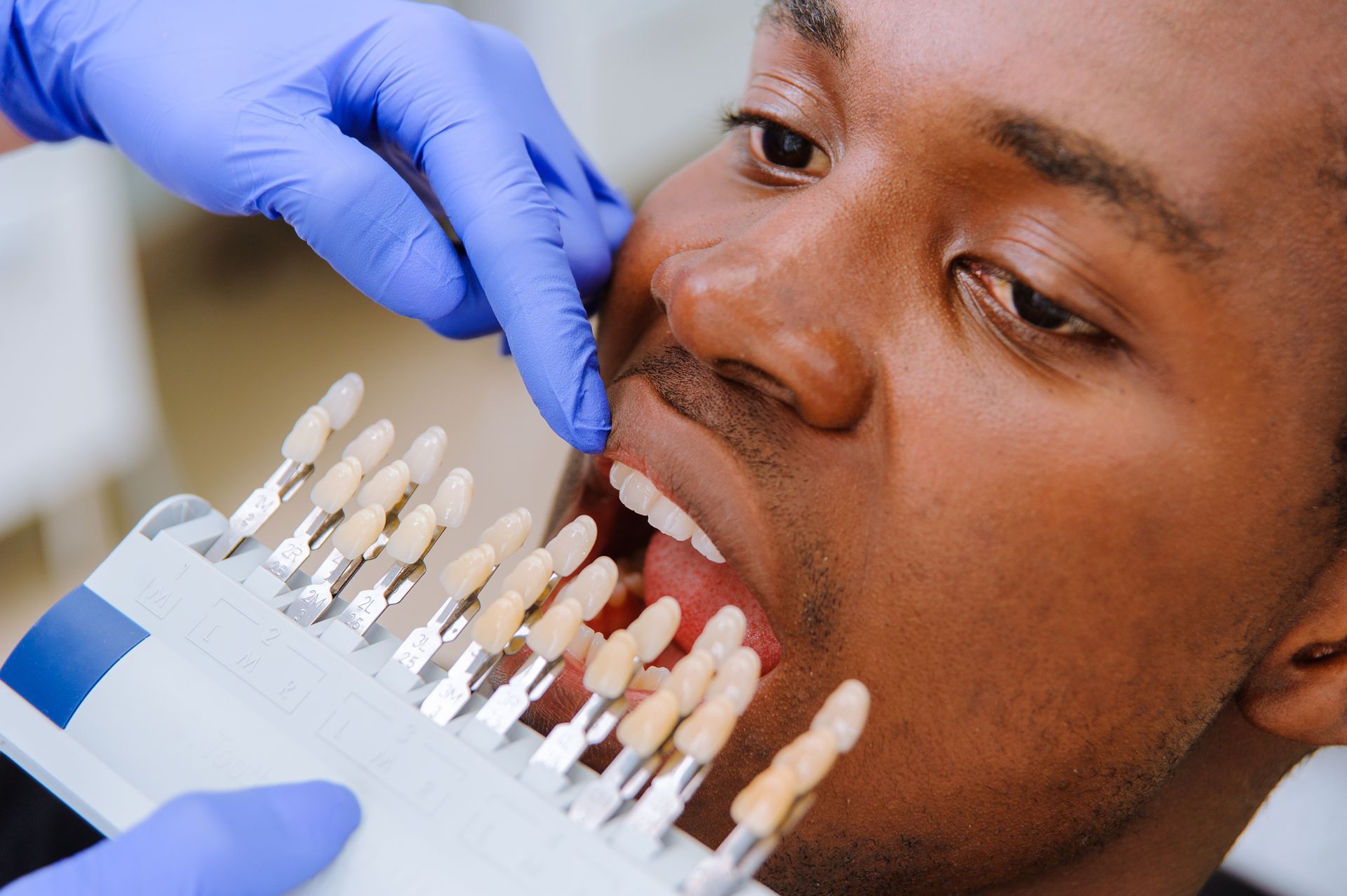 A dentist makes the process of cosmetic dentistry treatment, matching the colour of the teeth.