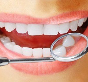 Human Teeth With Dentist Mirror - Dental Services in Tucson, AZ