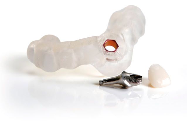 Artin Dental Simplant