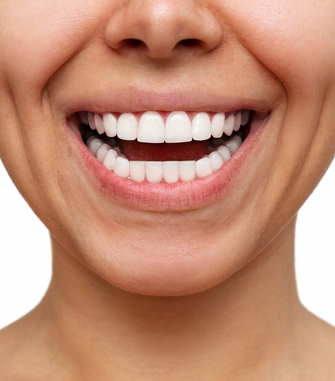 After Dental Cleaning