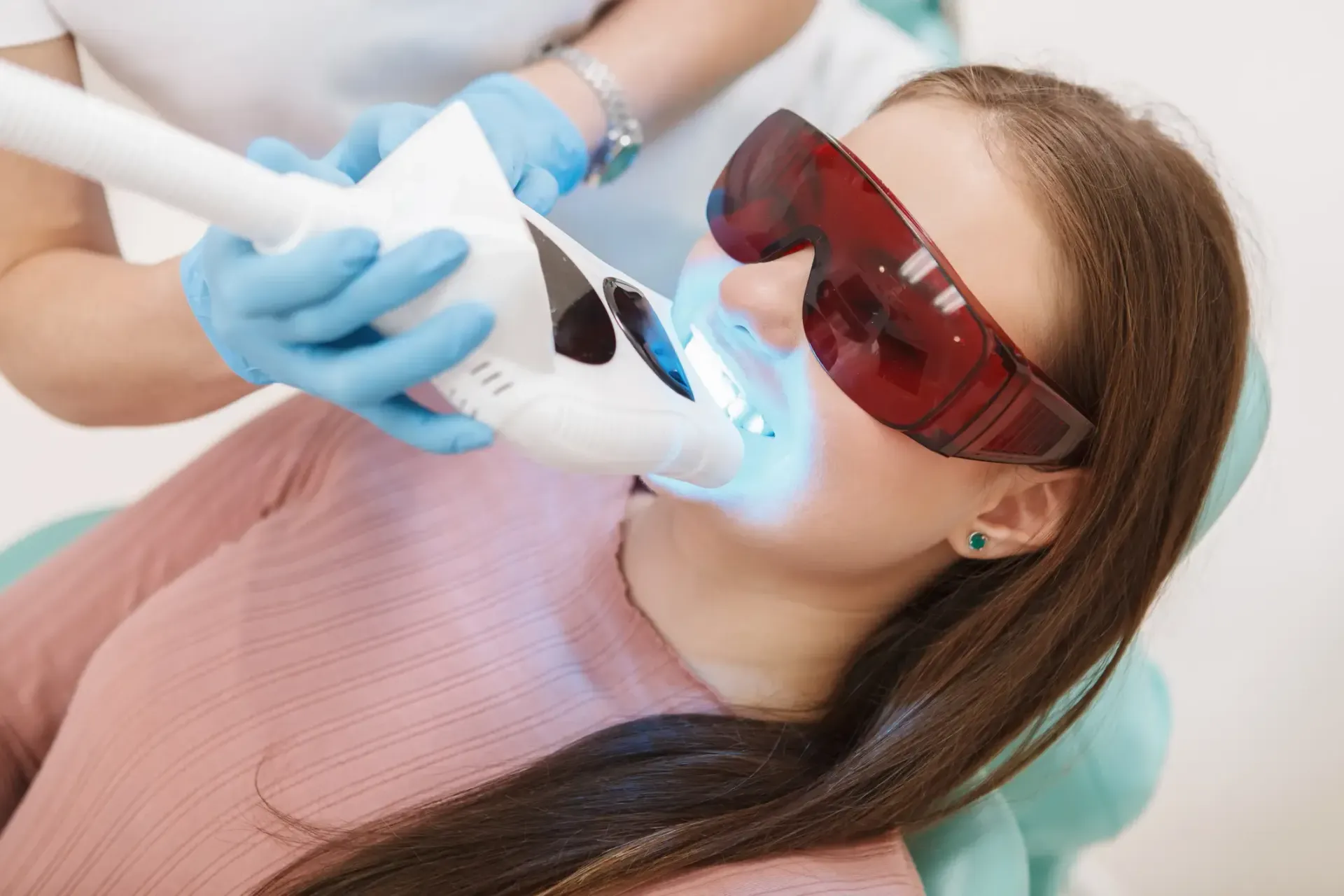 Zoom teeth whitening in Toronto
