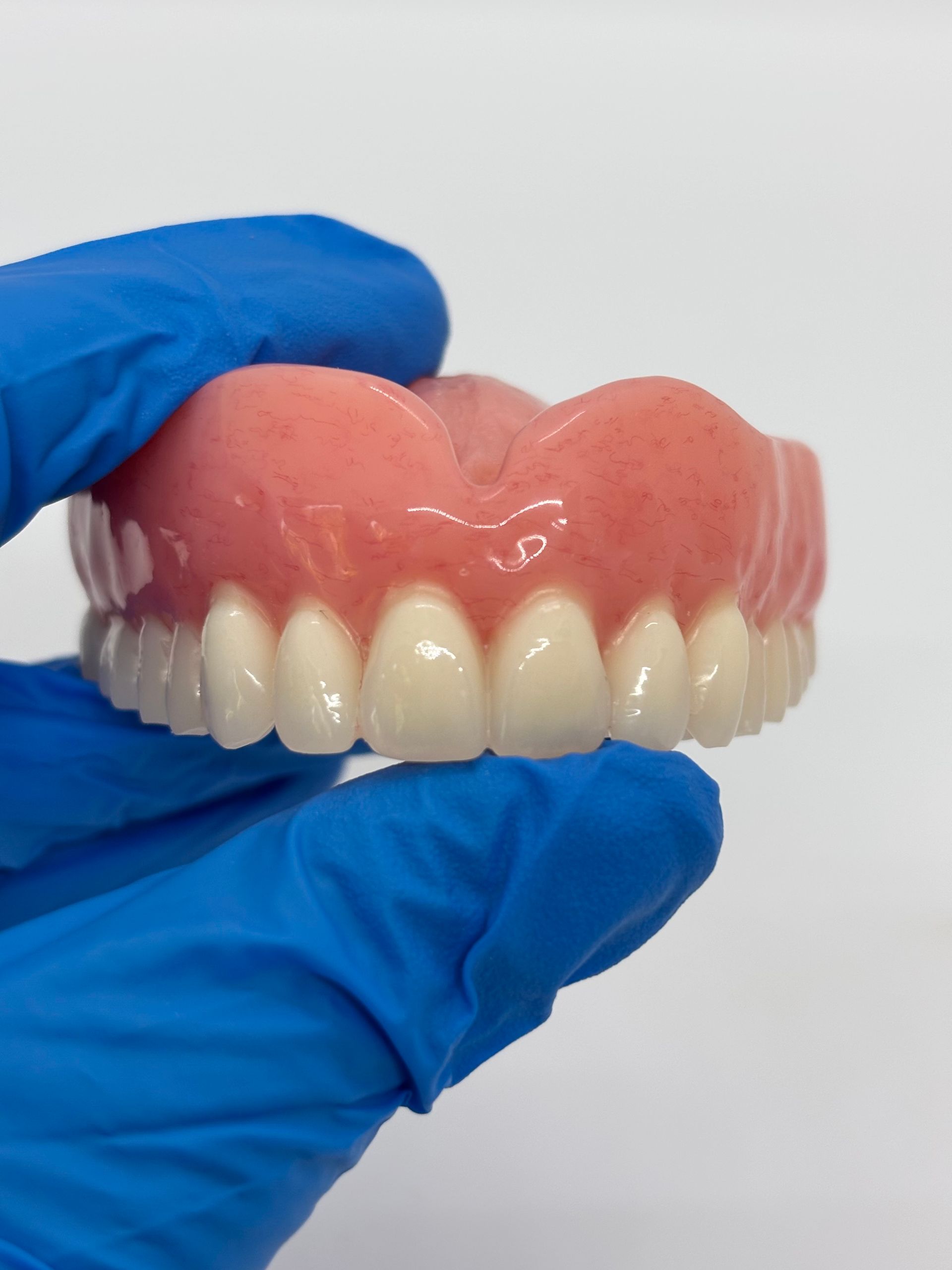 Blue-gloved Hand Holding Pink-and-white Dentures on a White Background — Precise Dentures in Berserker, QLD