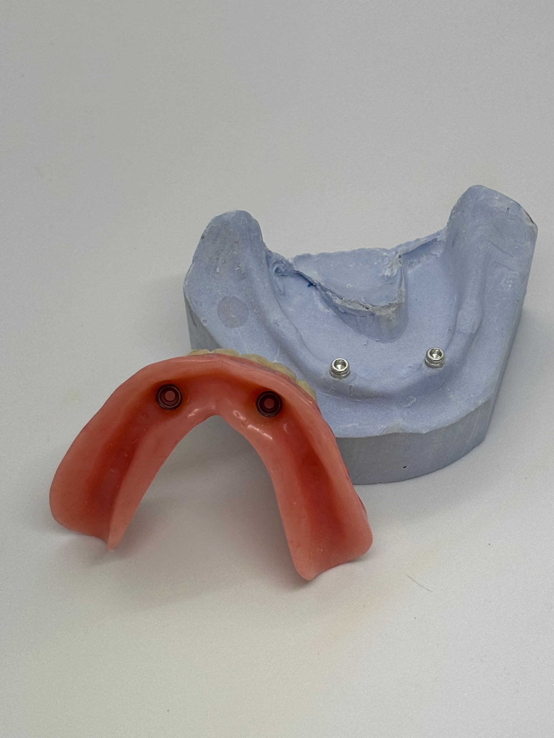 Two Dental Impression Molds, One Red and One Light Blue, on a Plain Background — Precise Dentures in Berserker, QLD