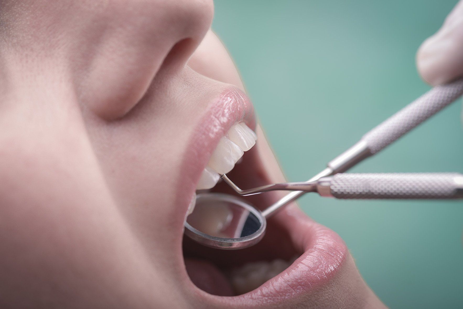 woman with mouth open at dentist | Gum disease therapy in NJ