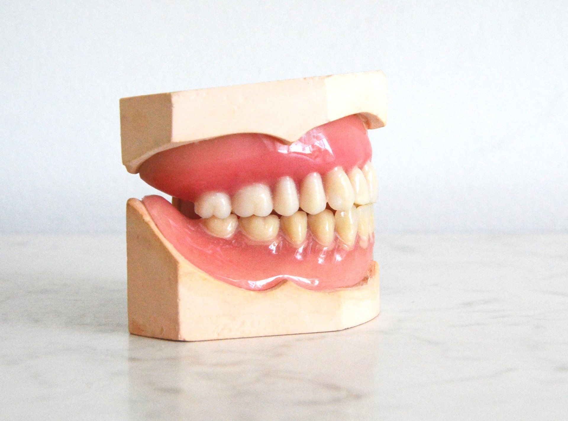 A set of dentures displayed in a tan model of gums, against a plain white background.