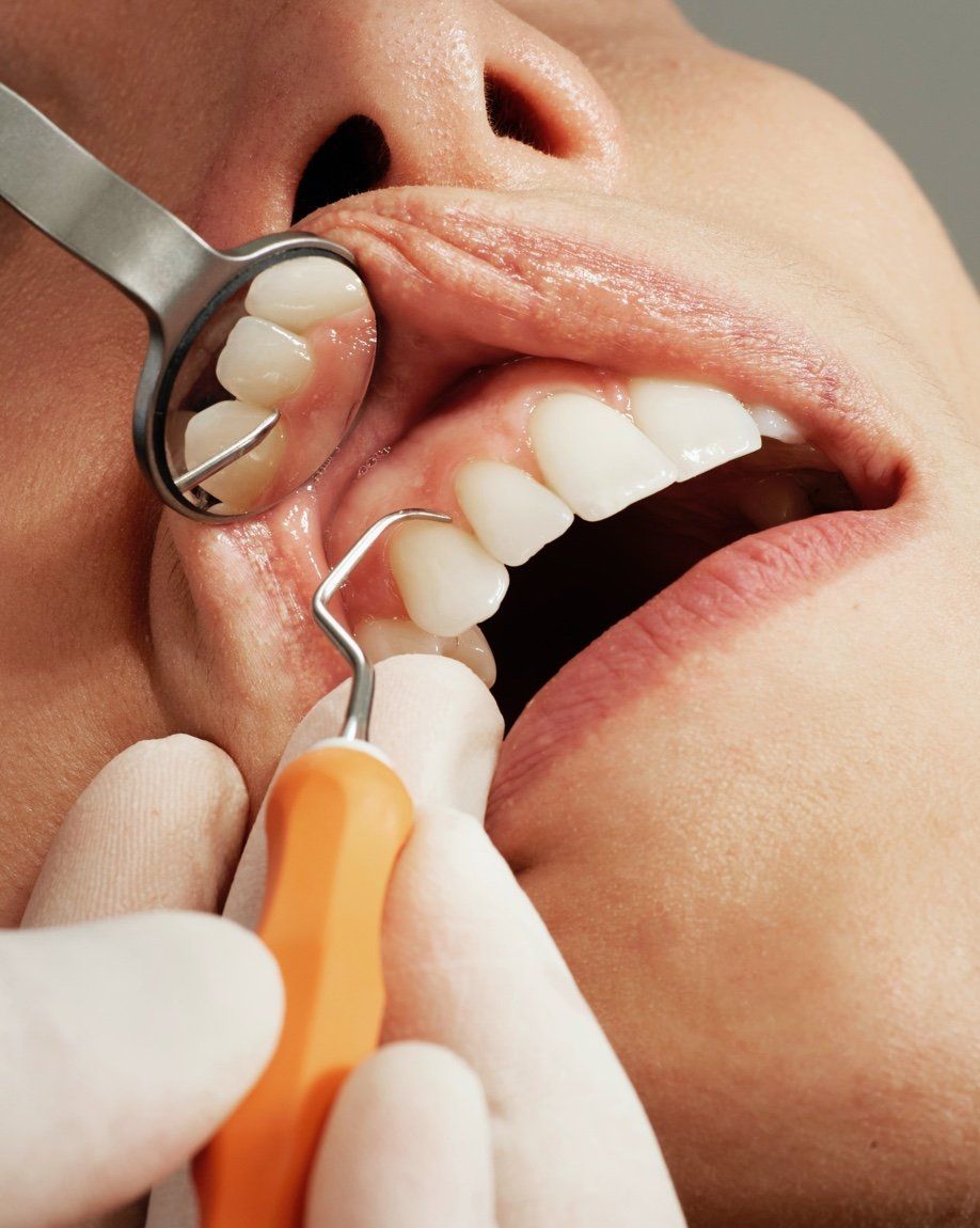 Dental examination in progress: dentist's gloved hand with tools examining a patient's open mouth and teeth.