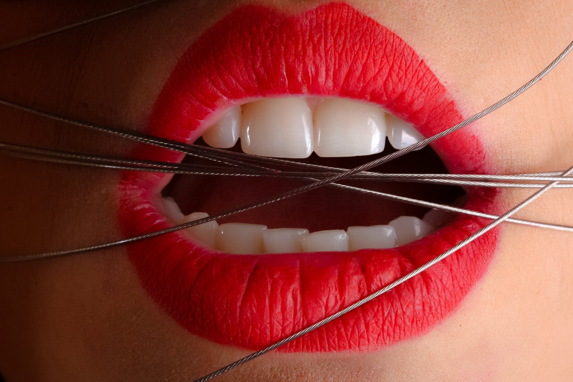 5 Teeth Whitening Mistakes You Should Avoid