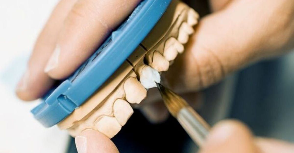 Dental Implants and Dentures Example | Best Orthodontist in Alexandria VA