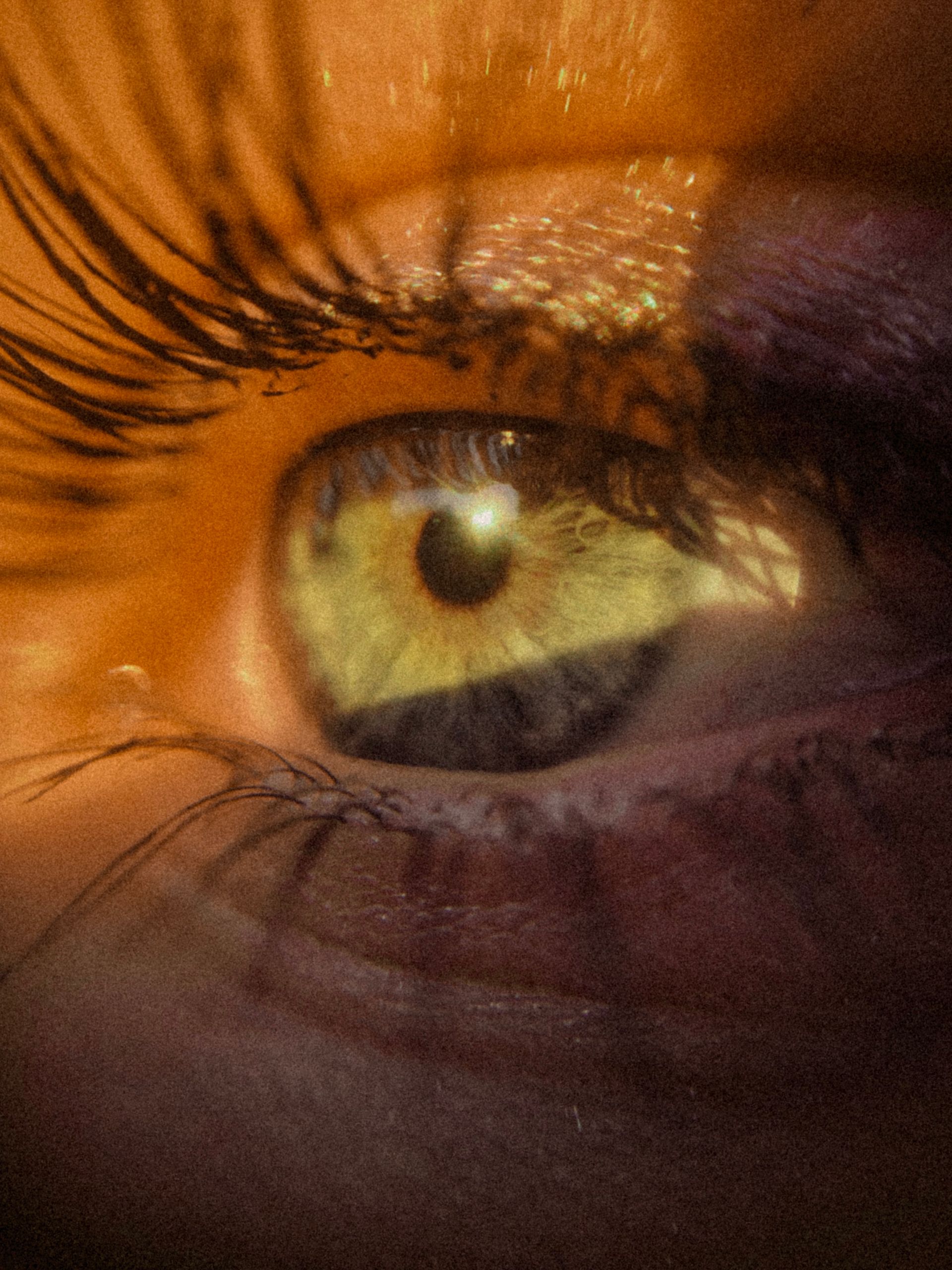 WHAT IS THE LEAST COMMON EYE COLOUR 