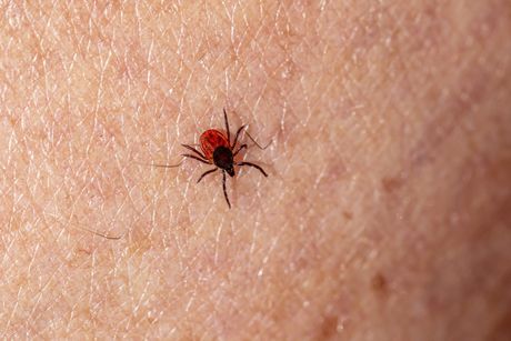 A tick is crawling on a person 's skin.