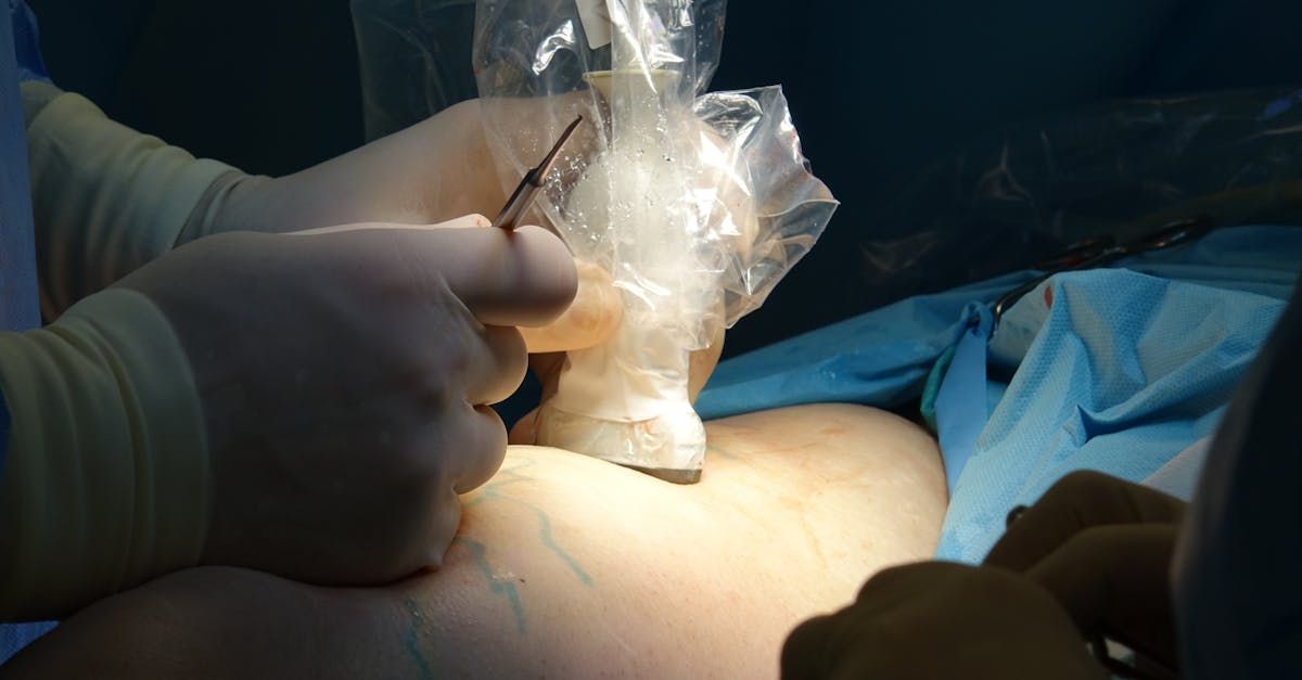 A surgeon is holding a plastic bag over a patient