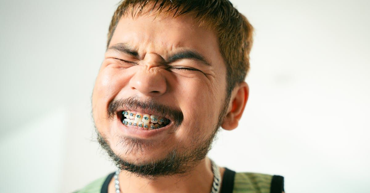 Should I Get a Dental Implant Before or After Braces?