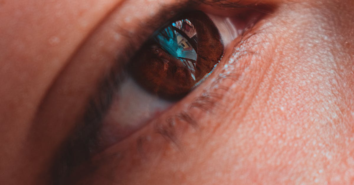 lose-up photo of a person's eyes after blepharoplasty surgery, showing smoother eyelids and a more a