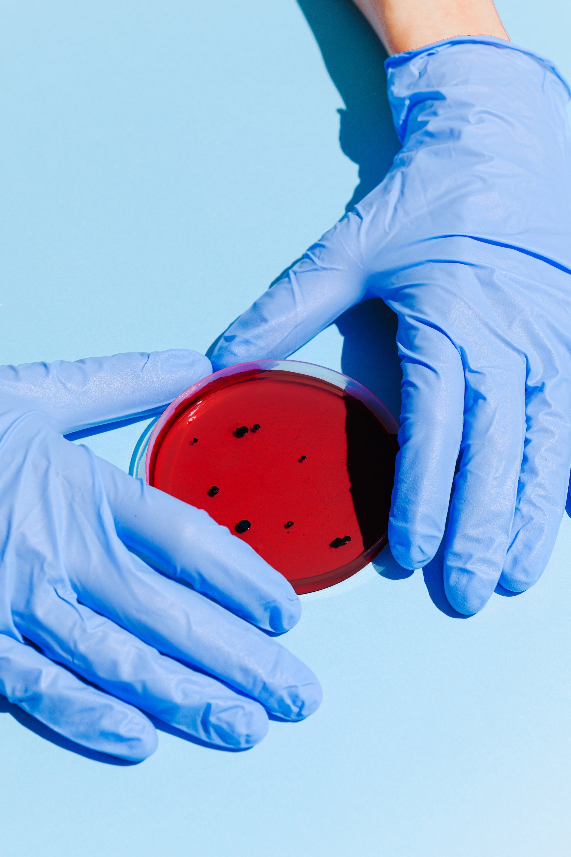 A person wearing blue gloves is holding a petri dish with red liquid in it.