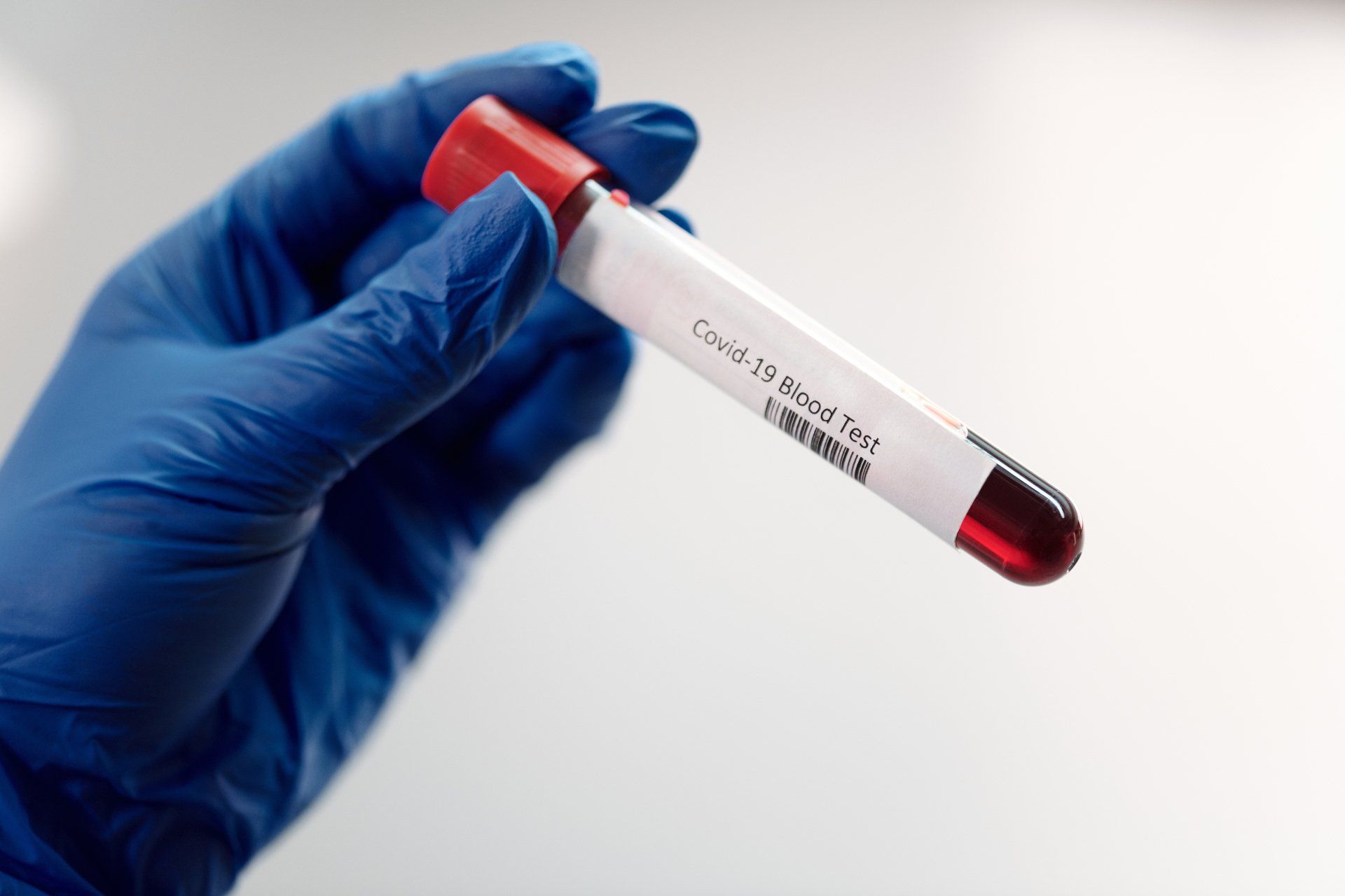 Thyroid Blood Labs: Here’s What You Need To Know.